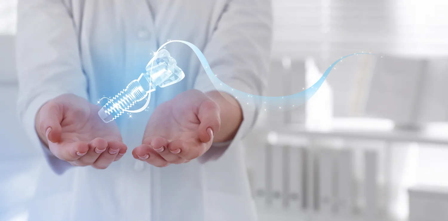 Ile kosztuje wymiana zębów na implanty?