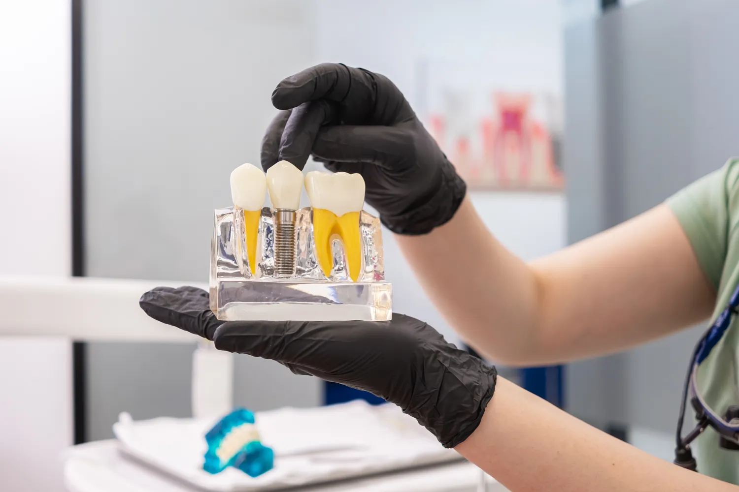 Na ile lat implanty zębów?