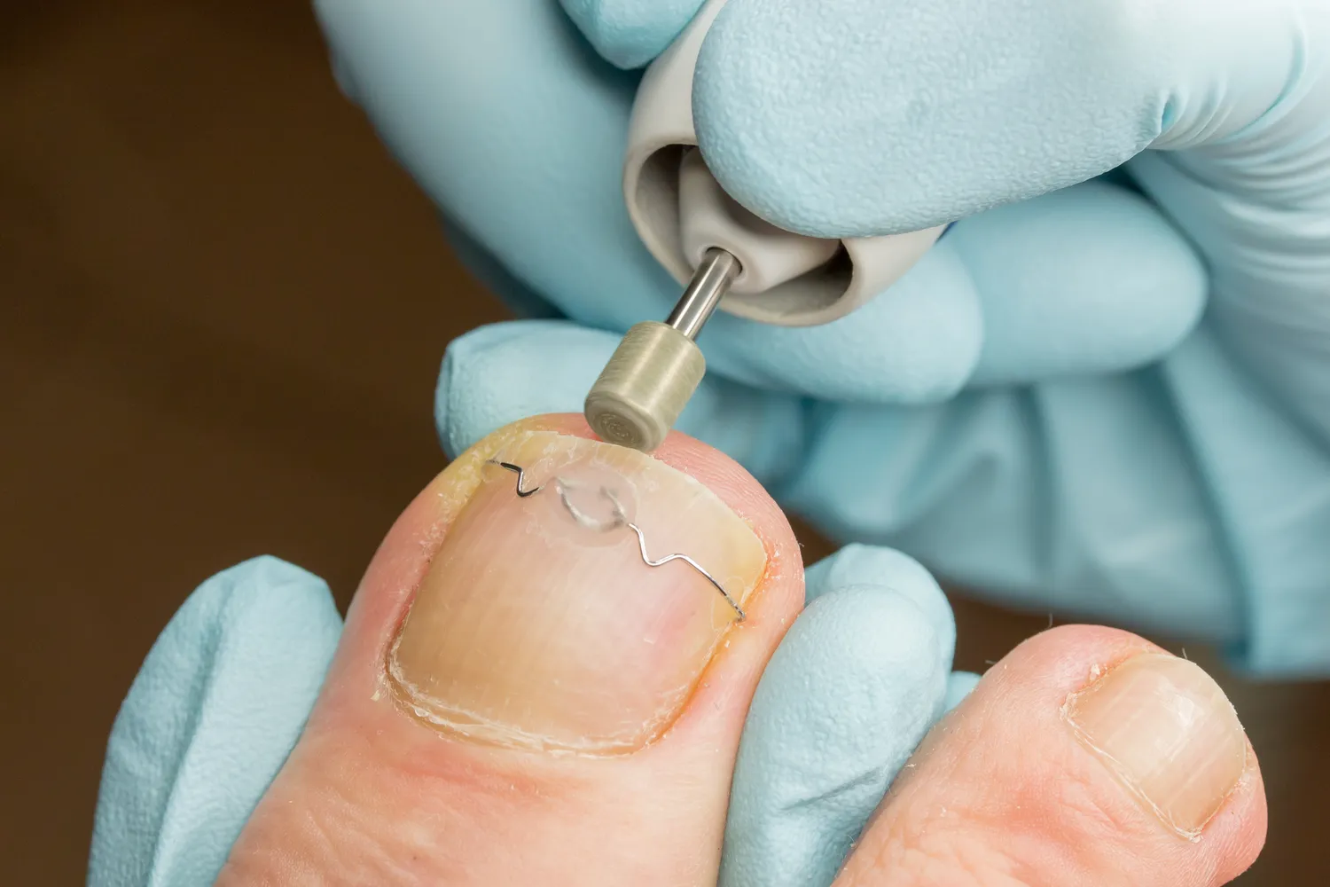 Podolog – co warto wiedzieć o tej profesji?