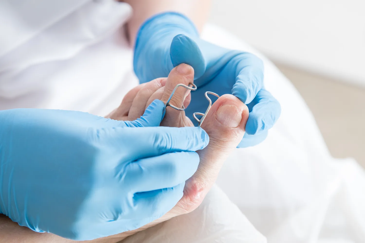 Twoje stopy potrzebują wyjątkowej troski? Odwiedź gabinet podologiczny!