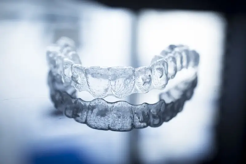 Invisalign kiedy efekty?